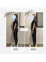 ラクリエ 東加古川院(La Creer)/お客様ビフォーアフター