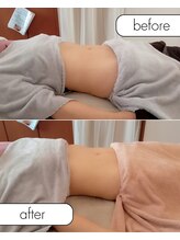 スイスパ(SUII SPA)/腸セラピー/肋骨調整