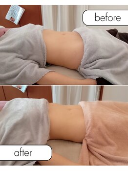 スイスパ(SUII SPA)/腸セラピー/肋骨調整