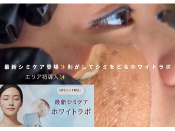 ウルト アルティメイトスキン(ULT ultimate skin)/ローマピンクから登場