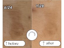 ユヌランコント 岐阜店(Une rencontre)/エンビロン×シミケア