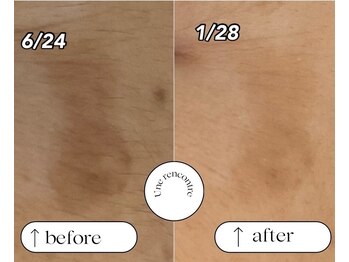 ユヌランコント 岐阜店(Une rencontre)/エンビロン×シミケア