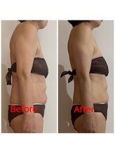 アイナ(Aina)/猫背改善し呼吸がラクに