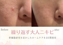 ソニョ(Sonyo)