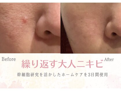 ソニョ(Sonyo)の写真
