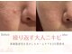 ソニョ(Sonyo)の写真