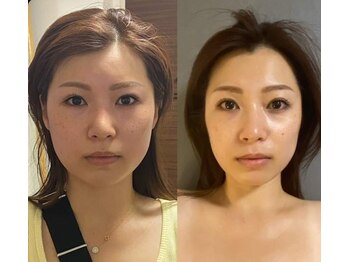アゴラ/【小顔】豊富な施術実績有り