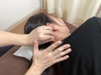 松尾美容鍼灸×整体 香椎/首回りの施術風景です