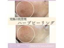 ルシアル(Rucial)の雰囲気（継続は美肌なり♪美容液導入とセットで驚きの変化を実感◎）