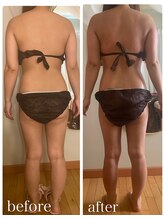 チャーム(Charm)/痩身　初回80分