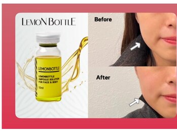 ウィズサロン(withサロン)/脂肪分解!!!