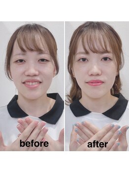 サラ デ ミレ(Sala de milae)/同時施術のお客様