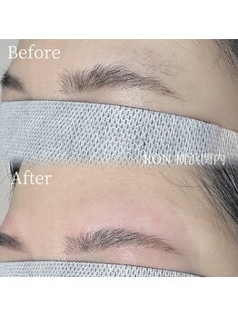 サロンロン 横浜関内(SALON RON)/眉毛/美容電気脱毛