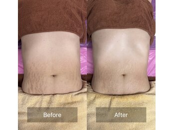 たかやなぎ整体院/産後のたるみでお悩みの方！