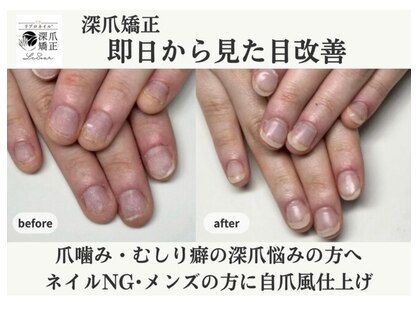 ローネイル(Raw nail)の写真