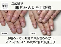ローネイル(Raw nail)