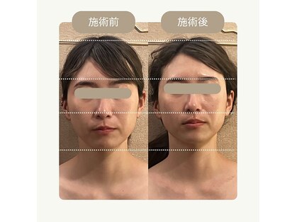 ブランシア 銀座(BLANCIA)の写真
