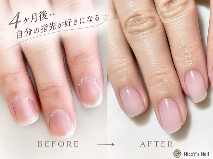 ニコワイズネイル(Nico Y's Nail)の写真