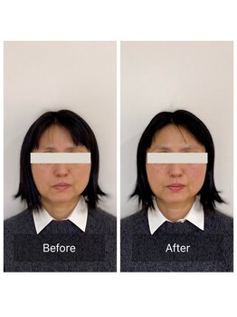 ハリラボ(hari Lab.)/【お客様の声】