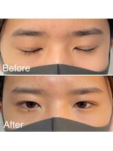 脱毛サロン メンズ 堂々/眉毛ワックス脱毛