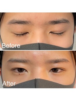 脱毛サロン メンズ 堂々/眉毛ワックス脱毛