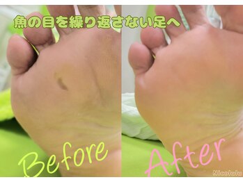 ニコルル 高崎店(Nicolulu)/繰り返さない足を目指す！
