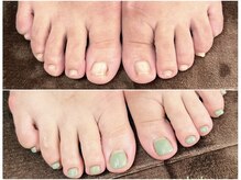 グレースレディ/伸びるのが遅いフットも2時間で