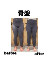 ビーバイビー(BBYB)/腰痛！なんとなくしんどい人に