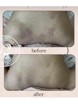 エヌ スタイル(N Style)/リベルハーブピーリング 