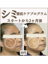 スイッチ(Switch)/皮膚科医監修コスメ使用2ヶ月で!