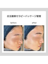 ポムハヌル(pom.haneul)/韓国肌管理室