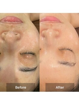 アンジェリーナ(Angelina.)/ハーブ★ビフォーアフター