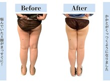 ビオラス 高崎店/原因は骨盤の歪みかも！？