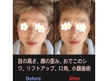 美容矯正サロン レレポノ(LELEPONO)/