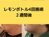 ◆レモンボトル3cc◆両フェイスラインをキュッと引き締め小顔へ◎¥15500→