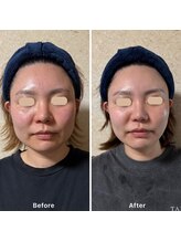 アイディー(Id)/大人気!整’形パック!