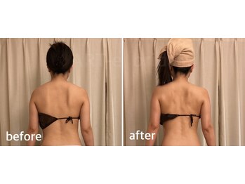 アルテ(ART-e)/全身100分コース/1回施術の変化