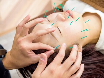 サニタ鍼灸整骨院 十日市場店/施術風景