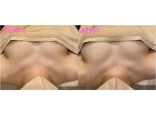 アファン 鶴見店(Afun)/【40代バスト】萎みがふっくら♪