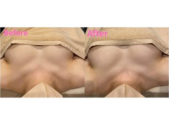 アファン 鶴見店(Afun)/【40代バスト】萎みがふっくら♪