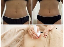 ナースのロミリンパ/