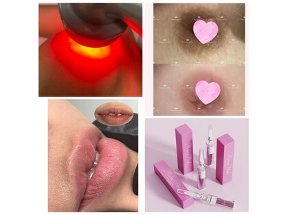 ファインボディ(Fine Body)の写真