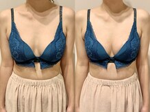 ティアモ(Ti Amo)/Before/After