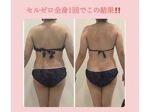 ビューティー アディクト(Beauty addict)/セルゼロで冬を乗り切ろう！