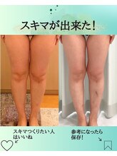 エデン(Eden)/美脚　太もも　ふくらはぎ