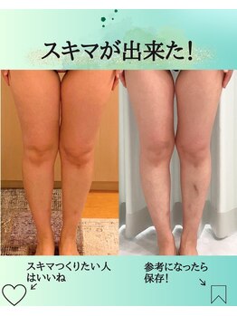 エデン(Eden)/美脚　太もも　ふくらはぎ