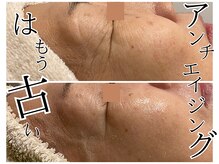 サロン ド リシャス(Salon de Licious)の雰囲気（＼時間を巻き戻す！？／今話題のエイジングケアに特化したサロン）