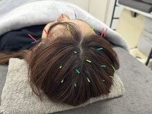 ラフテル鍼灸整骨院/眼精疲労/自律神経の乱れに♪