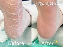 ディオフット(DIO FOOT)の雰囲気（巻き爪/陥入爪/肥厚爪/魚の目/タコ...痛みを解消, フットケアも!）