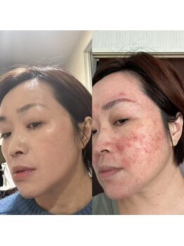 アバンギャルド(Avantgarde)/